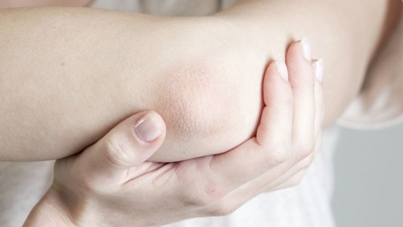 Những lưu ý khi trị thâm khuỷu tay