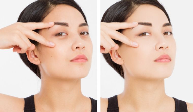 Các thành phần phổ biến trong kem trị quầng thâm mắt và lưu ý khi dùng