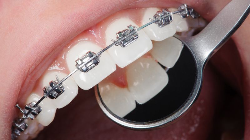"Mượn" hình ảnh các ca chỉnh nha của phòng khám khác