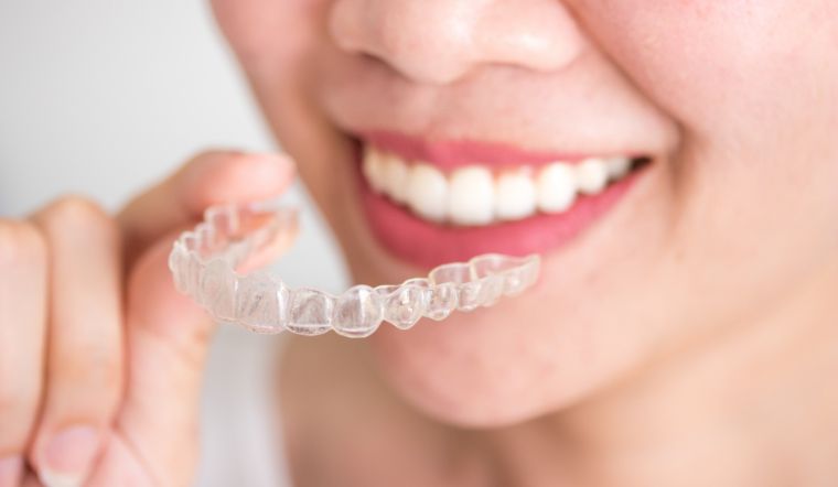 Khám chuẩn bị niềng răng mà có các dấu hiệu sau thì bạn nên cân nhắc