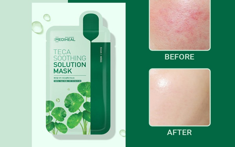 Mặt nạ Mediheal tinh chất rau má
