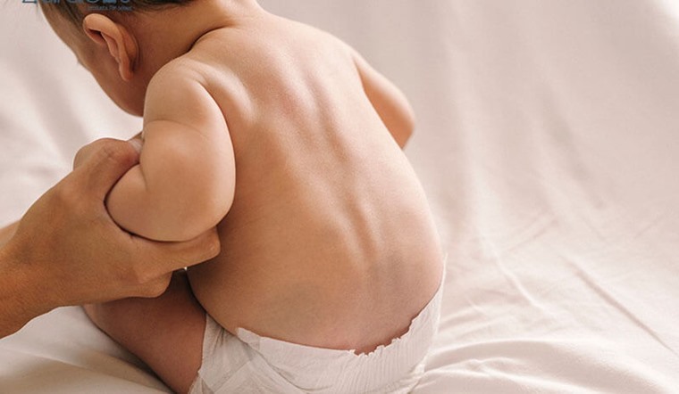 Cho trẻ tập ngồi sớm có bị gù lưng không? Dấu hiệu trẻ bị gù lưng