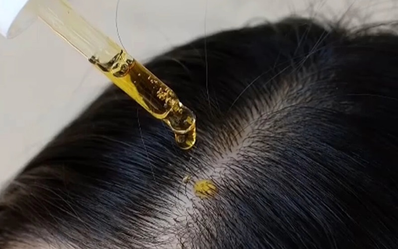 Serum mọc tóc là gì?