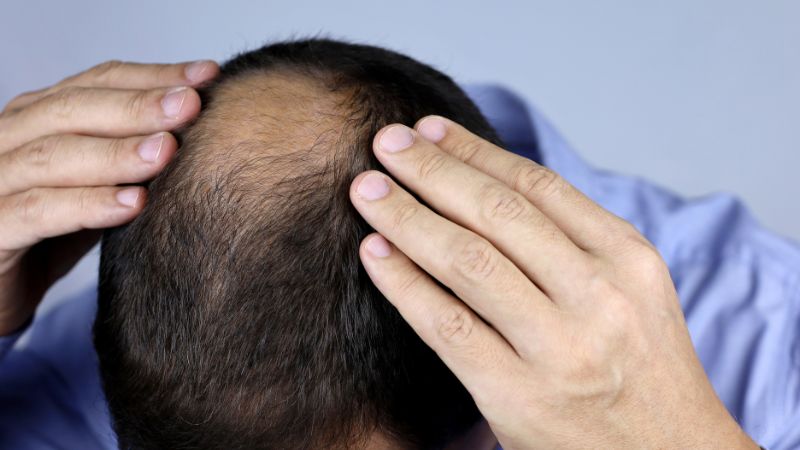 Thức khuya có làm rụng tóc hay không?