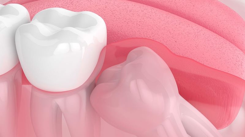 Một số câu hỏi thường gặp