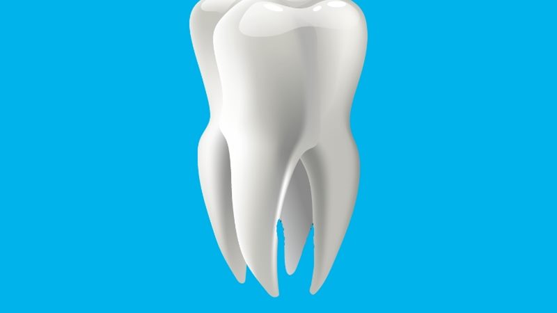 Cách phân biệt răng cấm và răng khôn
