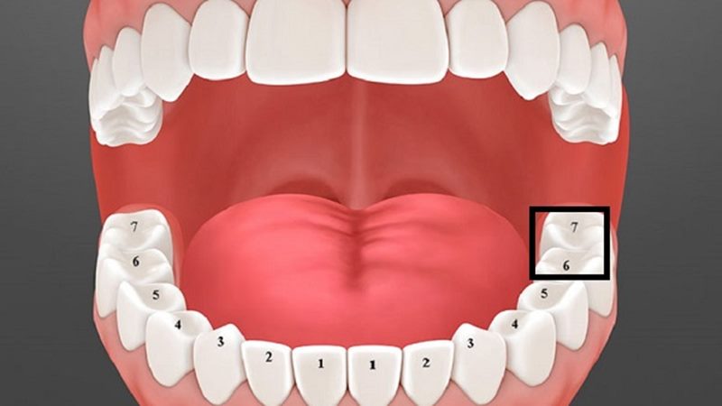 Những bệnh lý răng cấm thường gặp phải