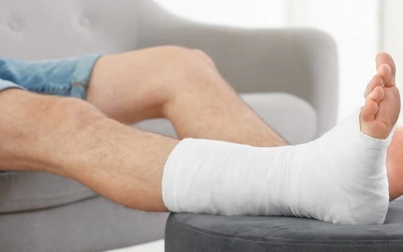 Phương pháp bó bột là một trong những cách điều trị phổ biến để giúp cố định xương Phương pháp bó bột là một trong những cách điều trị phổ biến để giúp cố định xương