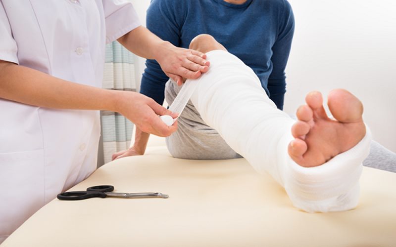 Lưu ý sau khi bó bột gãy xương Lưu ý sau khi bó bột gãy xương