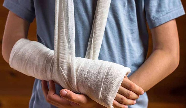 Bị gãy xương không bó bột có sao không? Cần lưu ý gì?