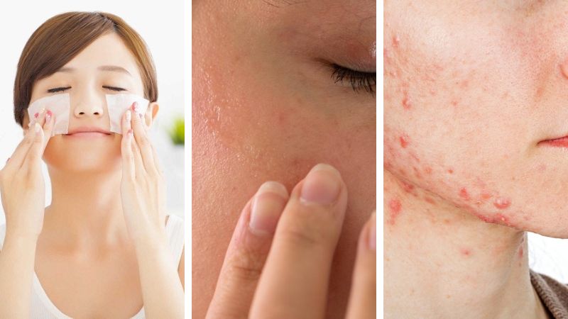 3 loại da chỉ nên rửa mặt bằng nước vào buổi sáng 3 loại da chỉ nên rửa mặt bằng nước vào buổi sáng