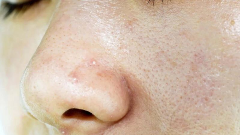 Dầu tự nhiên trên da lại chứa vitamin E có tác dụng giúp chống oxy hóa Dầu tự nhiên trên da lại chứa vitamin E có tác dụng giúp chống oxy hóa