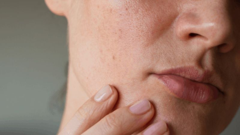 Người có làn da khô cũng cần sữa rửa mặt Người có làn da khô cũng cần sữa rửa mặt