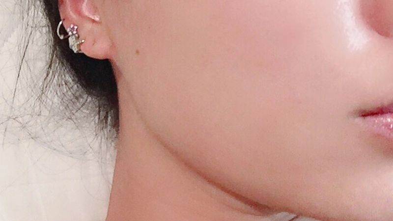 Một làn da trắng sữa là làn da như thế nào?