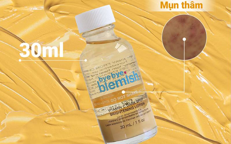 Tinh chất chấm mụn Bye Bye Blemish Vitamin C Dark Spot Brightening Lotion Tinh chất chấm mụn Bye Bye Blemish Vitamin C Dark Spot Brightening Lotion