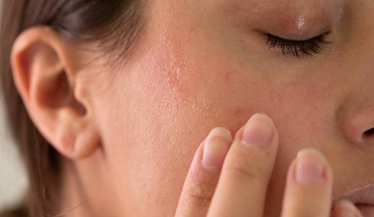 Da khô sạm là vì sao? Nguyên nhân và cách xử lý