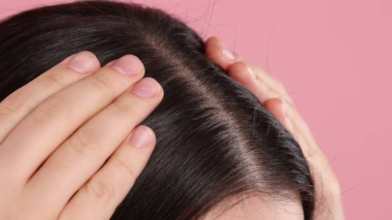 Lợi ích của việc tẩy tế bào chết da đầu