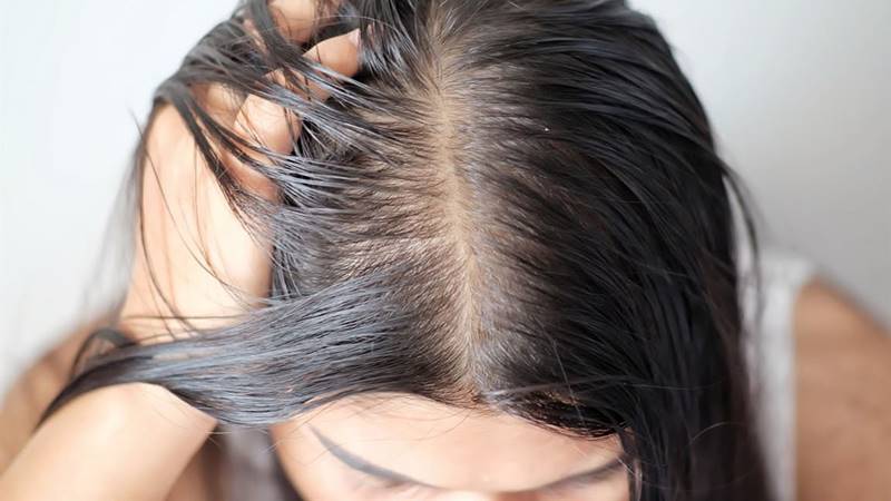 Có nên tẩy da chết cho da đầu?