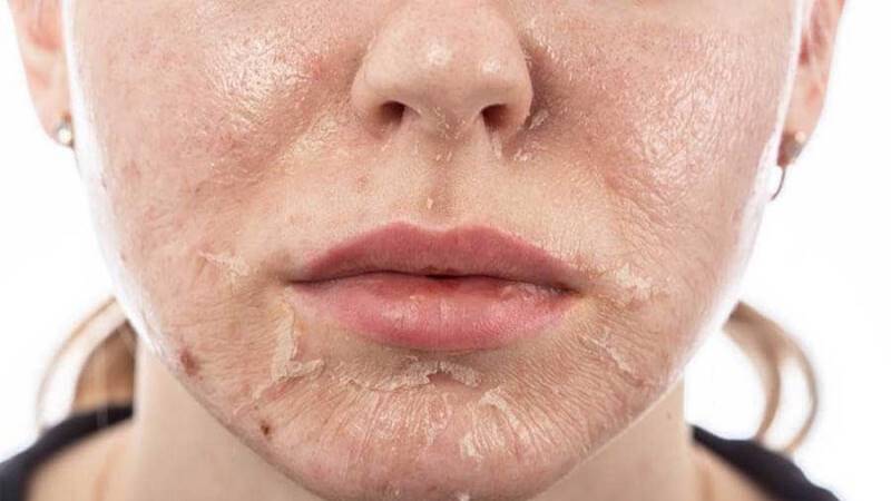 Có nên xài thuốc bắc tái tạo da? Lời khuyên từ chuyên gia