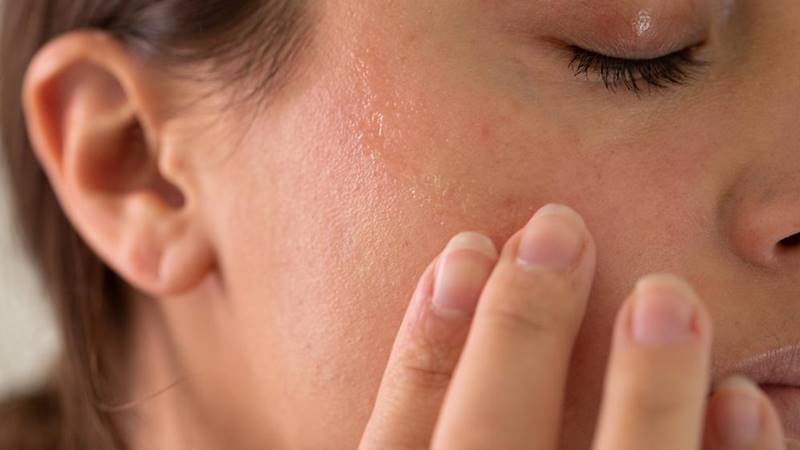 Cách ngăn ngừa tình trạng da thiếu nước