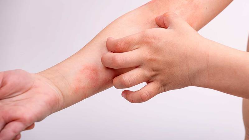 Các phương pháp điều trị y tế