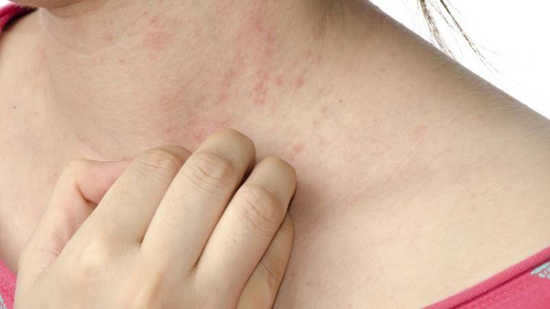 Ngứa ngáy, khó chịu