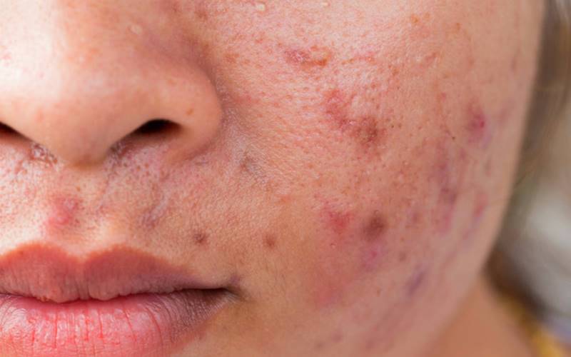 Các câu hỏi thường gặp