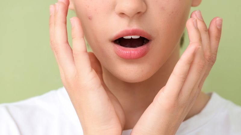 Sử dụng sản phẩm đặc trị tăng sắc tố da mặt