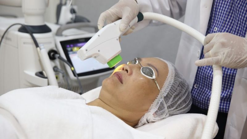 Điều trị da bằng liệu pháp ánh sáng (IPL)