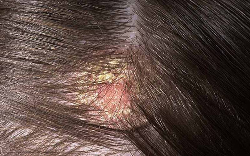 Các câu hỏi thường gặp Các câu hỏi thường gặp