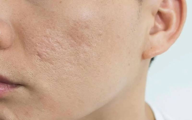 Các vấn đề về da thường gặp và cách xử lý