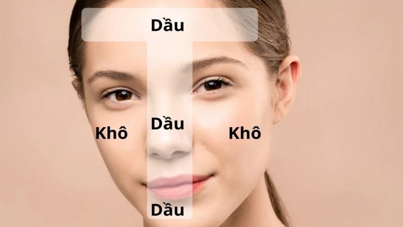 Da hỗn hợp