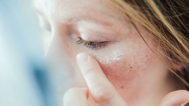 Lưu ý để bảo vệ da không bị cháy nắng