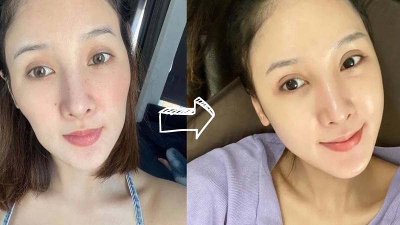 Lưu ý quan trọng khi thực hiện các mẹo căng da mặt