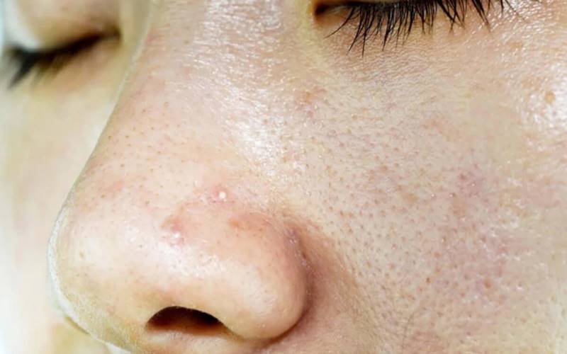 Cơ chế sản xuất dầu tự nhiên của da