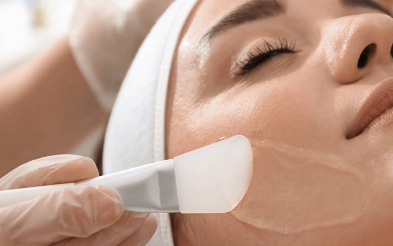 Peel da trị mụn có an toàn không?