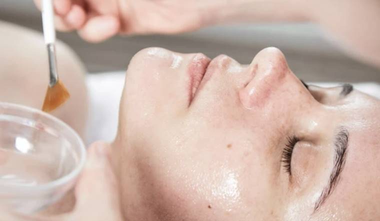 Peel da trị mụn là gì? Peel da mụn có tốt không?