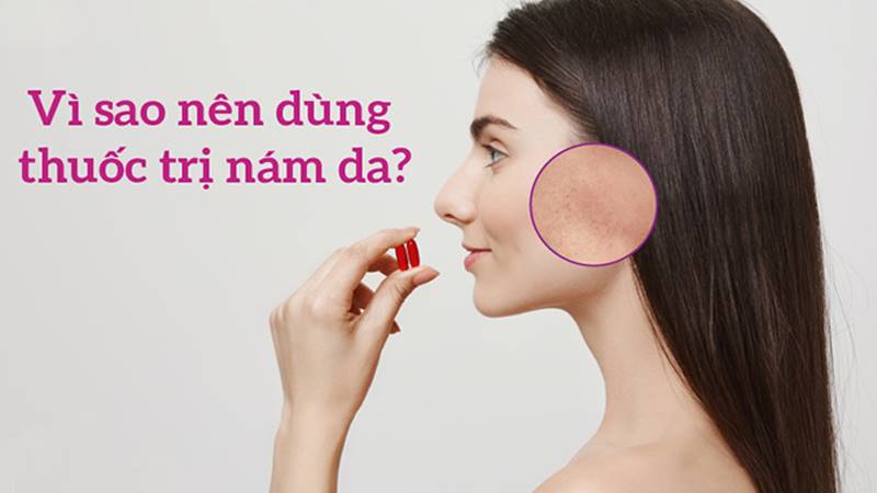 Sử dụng thuốc uống trị nám