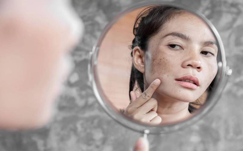 Vị trí xuất hiện nám