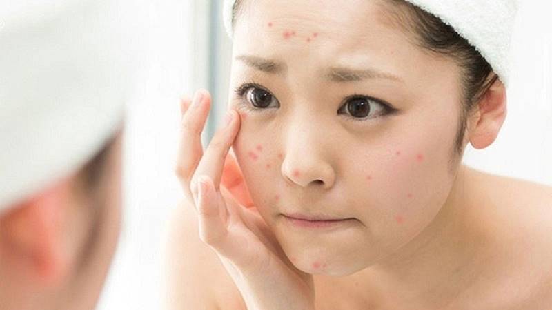 Vệ sinh da không đúng cách