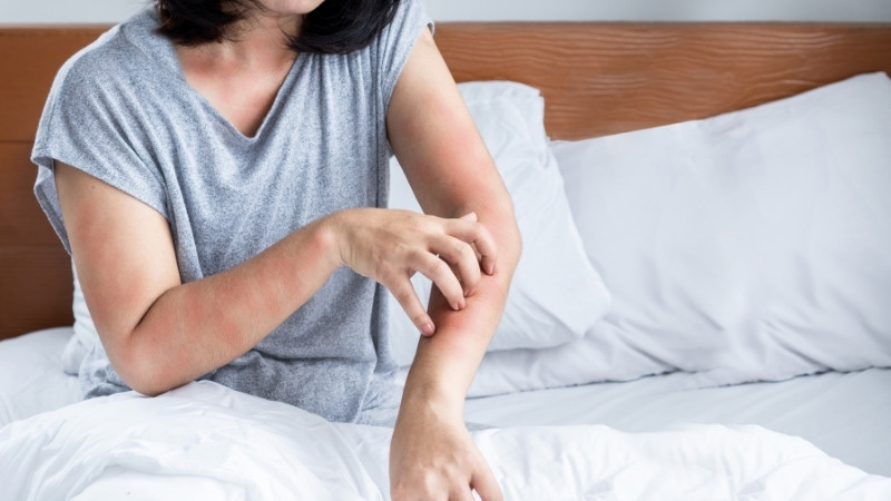 Tác hại của rau diếp cá - Dị ứng