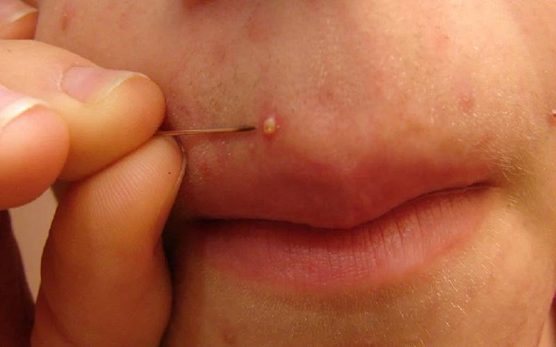 Các câu hỏi thường gặp
