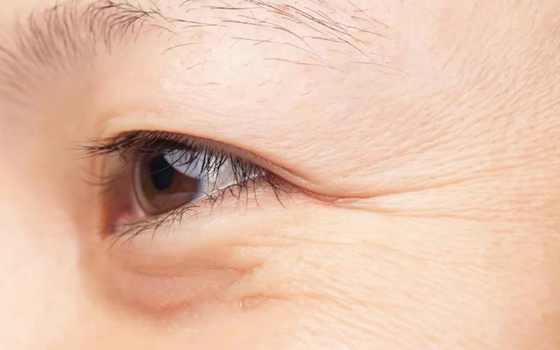 Nâng cơ mặt trẻ hóa làn da