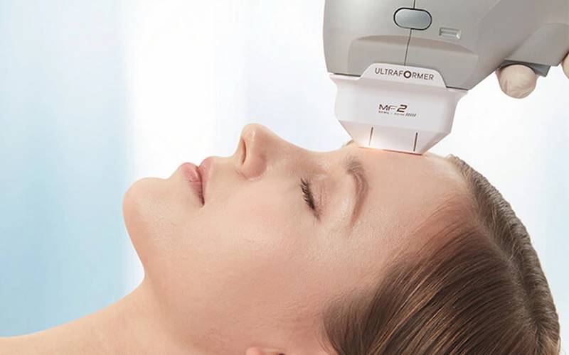 Nâng cơ mặt không xâm lấn hoặc ít xâm lấn