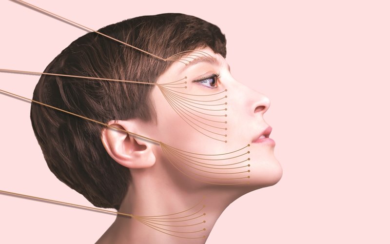 Nâng cơ mặt xâm lấn bằng phẫu thuật