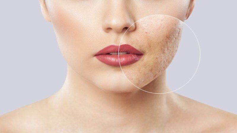 Da thiếu ẩm, mất nước