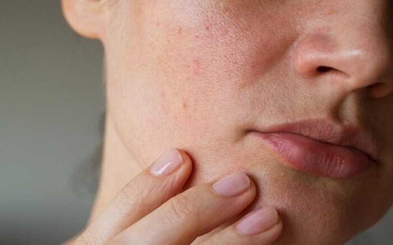 Các câu hỏi thường gặp