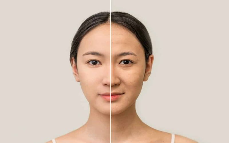 Quá trình lão hóa tự nhiên