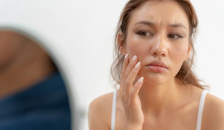 Da xỉn màu, thiếu sức sống do đâu? Cách cải thiện làn da rạng ngời