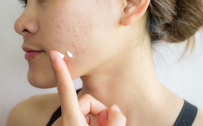 Biện pháp phòng ngừa dị ứng da